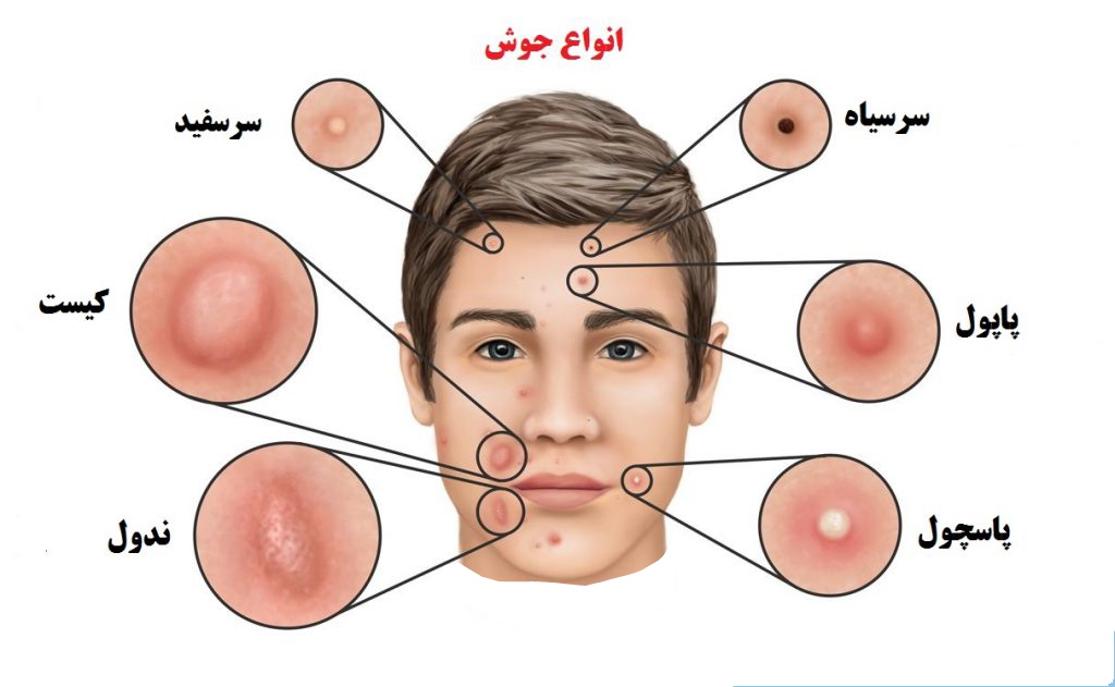 انواع جوش