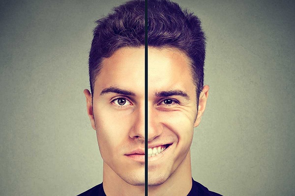 اختلال دو قطبی