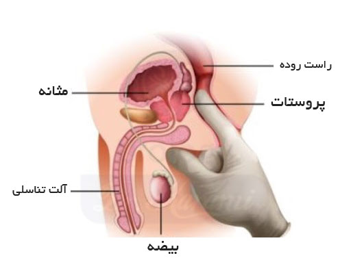 محل قرار گرفتن پروستات