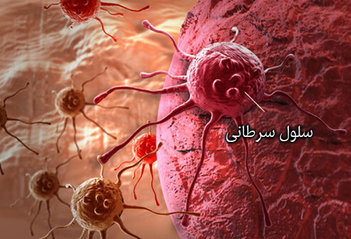 سلول سرطانی در مغز