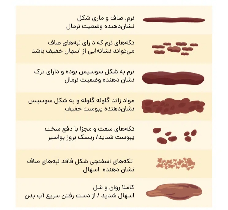 انواع شکل مدفوع