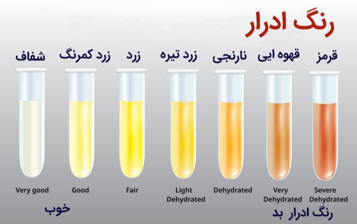 هر رنگ ادرار معنایی متفاوت دارد.