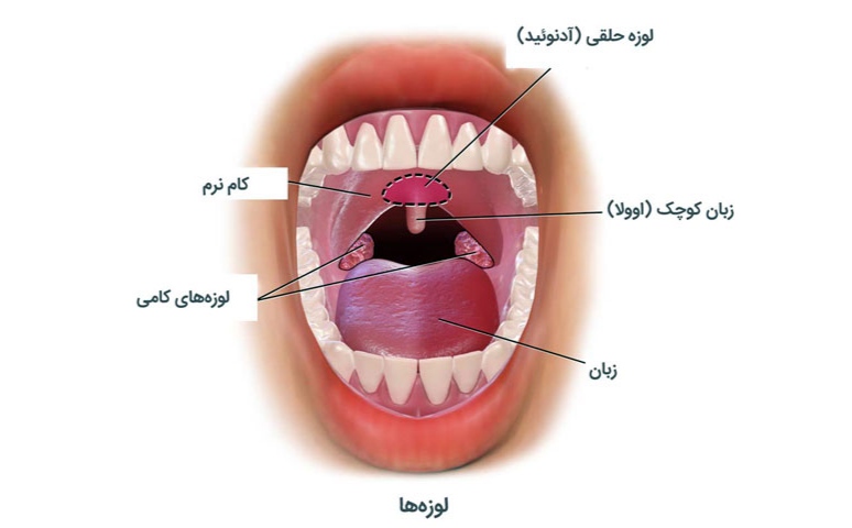 لوزه‌ها در انتهای دهان و نزدیکی حلق واقع هستند.