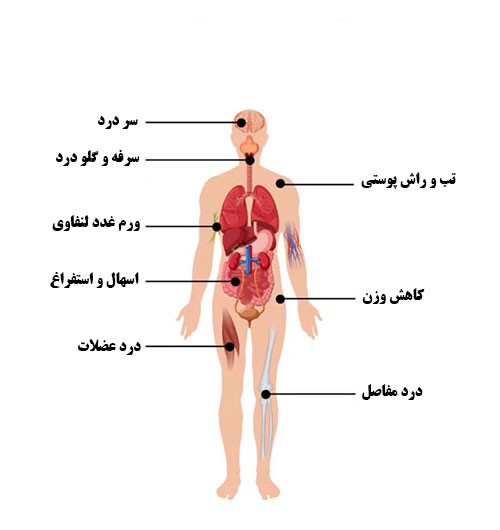 علائم عفونت حاد بیماری ایدز