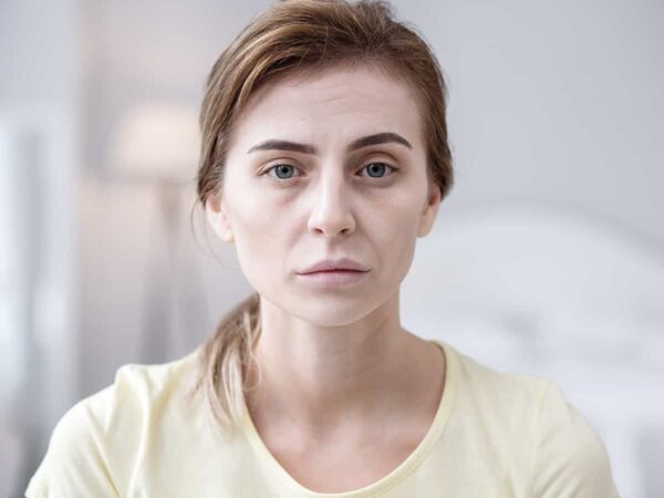 تصویر فردی مبتلا به کم خونی