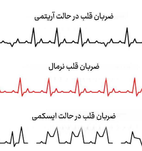 ضربان قلب
