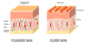 تفاوت کلاژن در دو وضعیت پوست.png