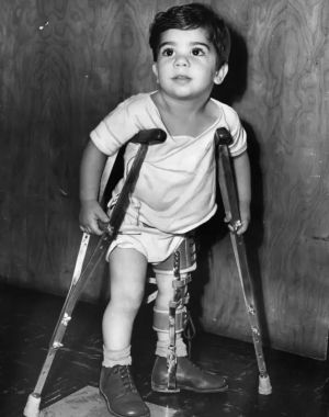 تصویری از کودکی مبتلا به فلج اطفال